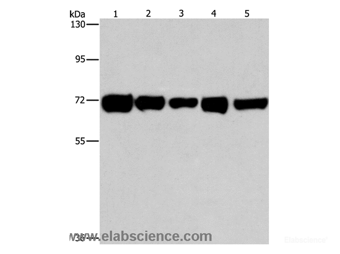 Western Blot analysis of Hela, A549 and MCF7 cell, Human liver cancer and lung cancer tissue using RPN1 Polyclonal Antibody at dilution of 1:550