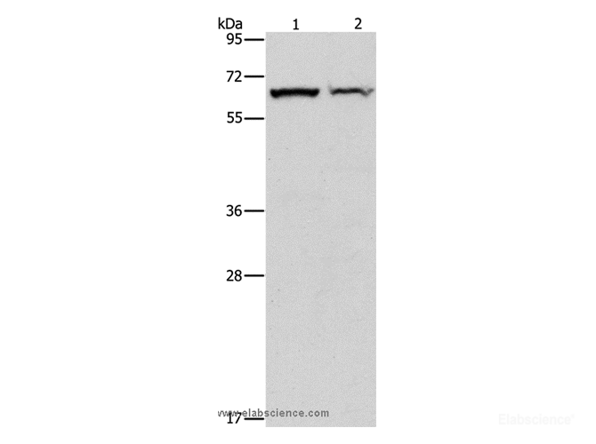 Western Blot analysis of Mouse pancreas and Human fetal liver tissue using CBS Polyclonal Antibody at dilution of 1:550