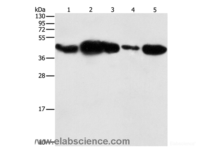 Western Blot analysis of HepG2 cell and Human fetal placenta tissue, 293T cell and Human testis tissue, NIH/3T3 cell using PGK2 Polyclonal Antibody at dilution of 1:600