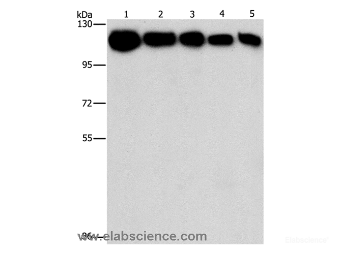 Western Blot analysis of A431, K562, 231, hela and hepG2 cell using HK2 Polyclonal Antibody at dilution of 1:1200