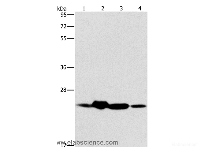 Western Blot analysis of Mouse spleen and Human fetal liver tissue, hela cell and Human fetal brain tissue using THOC7 Polyclonal Antibody at dilution of 1:450