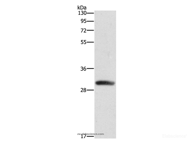 Western Blot analysis of Mouse heart tissue using DCK Polyclonal Antibody at dilution of 1:550