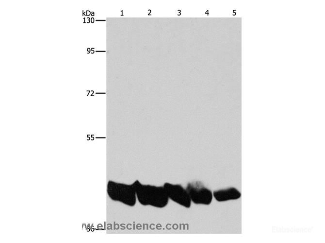 Western Blot analysis of A549 and hela cell, Mouse liver and Human liver tissue, hepG2 cell using PGK1 Polyclonal Antibody at dilution of 1:850