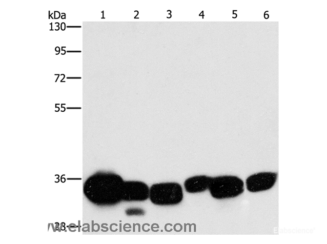 Western Blot analysis of Mouse liver and Human fetal lung tissue, hela cell and Mouse kidney tissue, Human brain malignant glioma tissue and K562 cell using CBR1 Polyclonal Antibody at dilution of 1:1000