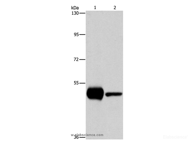 Western Blot analysis of K562 and Mouse brain tissue using PIP4K2A Polyclonal Antibody at dilution of 1:1150