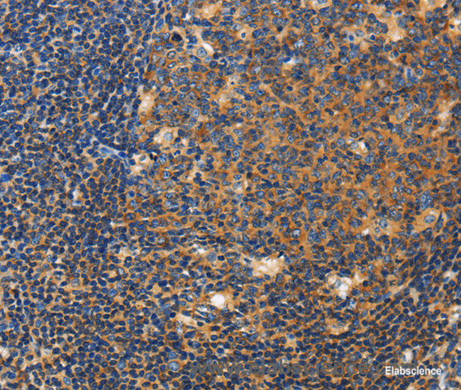 Immunohistochemistry of paraffin-embedded Human tonsil tissue using CERK Polyclonal Antibody at dilution 1:50