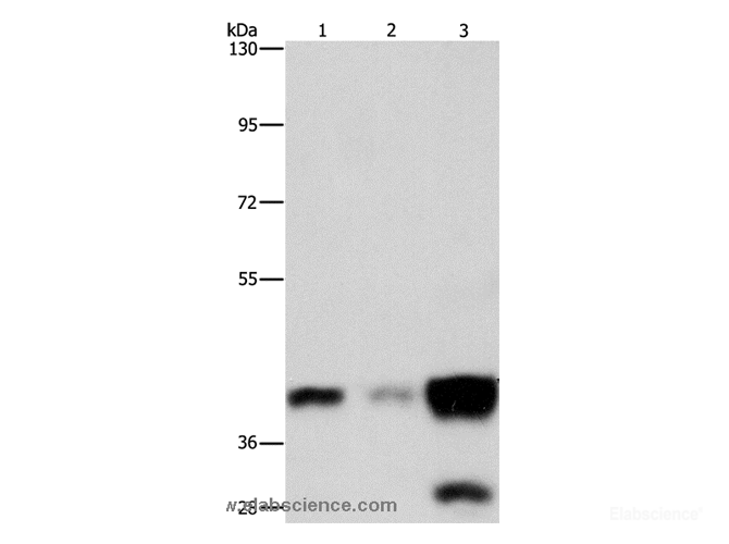 Western Blot analysis of Human colon cancer tissue, Human fetal brain and fetal lung tissue using ASAH1 Polyclonal Antibody at dilution of 1:800