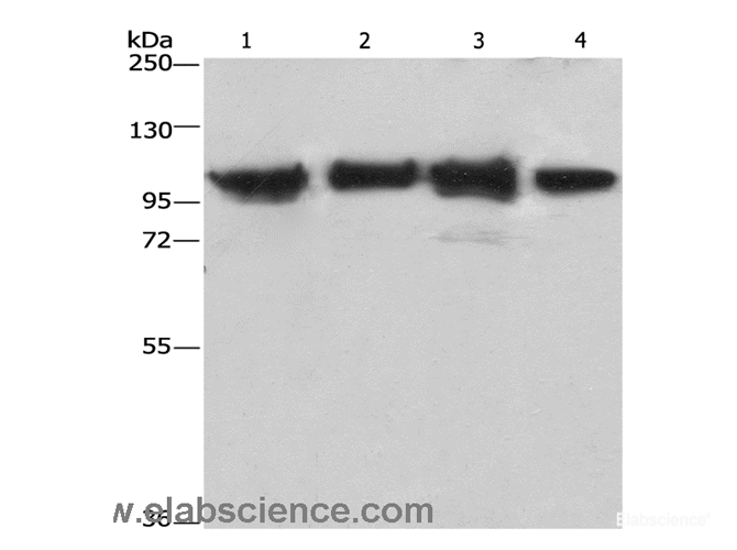 Western Blot analysis of Lovo cell and Mouse kidney tissue, 231 and hepG2 cell using ACTN4 Polyclonal Antibody at dilution of 1:485