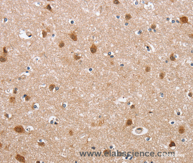 Immunohistochemistry of paraffin-embedded Human brain tissue using DEFA6 Polyclonal Antibody at dilution 1:40