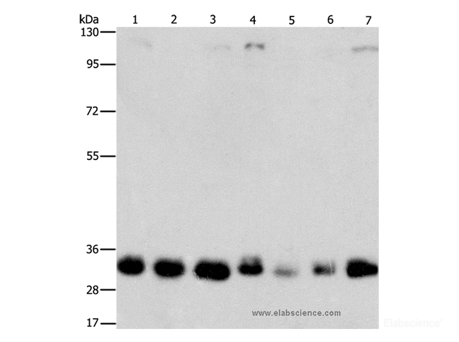 Western Blot analysis of 231, 293T, Lovo, hepG2, A549, PC3 and A172 cell using MPG Polyclonal Antibody at dilution of 1:1500