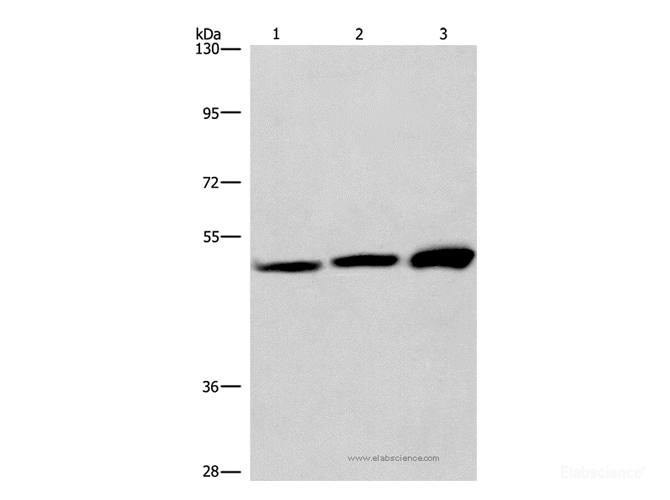 Western Blot analysis of adrenal pheochromocytoma tissue,Jurkat and A549 cell using VWA5A Polyclonal Antibody at dilution of 1:275