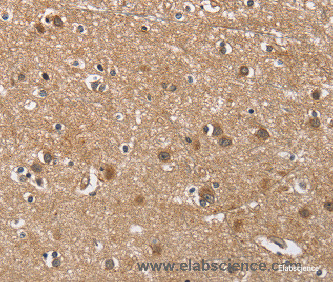 Immunohistochemistry of paraffin-embedded Human brain tissue using BUB1 Polyclonal Antibody at dilution 1:60