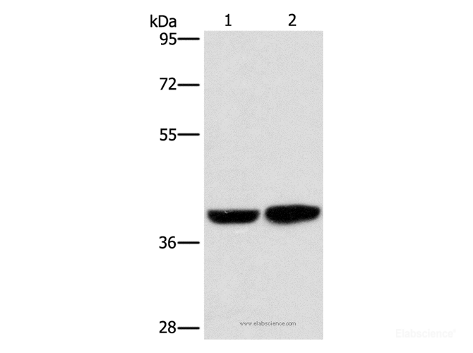 Western Blot analysis of Human fetal brain tissue and 231 cell using CAB39L Polyclonal Antibody at dilution of 1:350