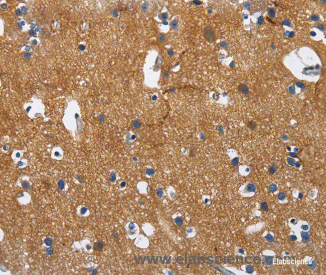 Immunohistochemistry of paraffin-embedded Human brain tissue using CADM3 Polyclonal Antibody at dilution 1:40