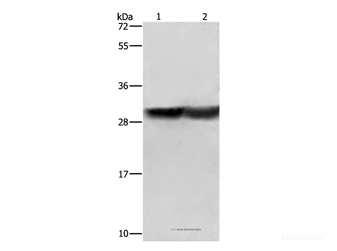 Western Blot analysis of Human fetal brain and Mouse kidney tissue using CALB1 Polyclonal Antibody at dilution of 1:600