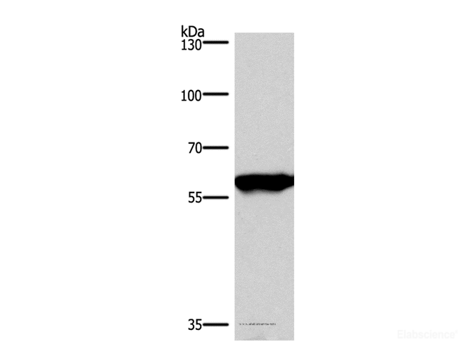 Western Blot analysis of Mouse brain tissue using PPP3CA Polyclonal Antibody at dilution of 1:900
