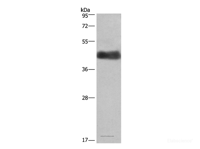 Western Blot analysis of Human placenta tissue using CALU Polyclonal Antibody at dilution of 1:400