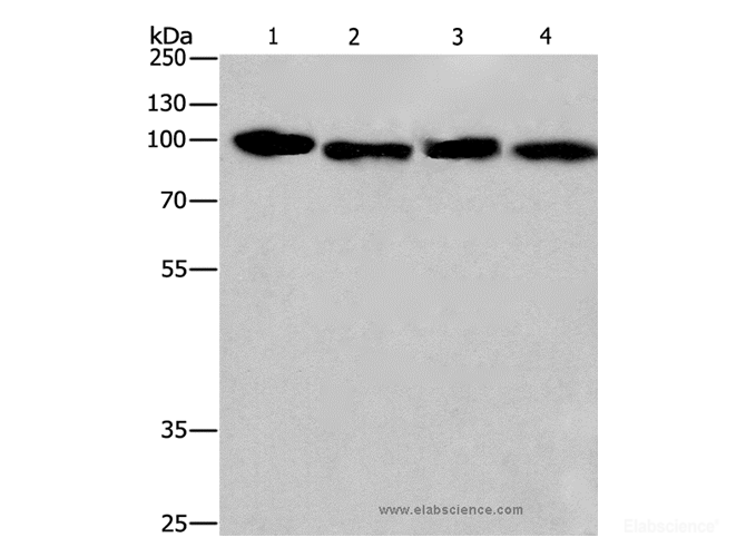 Western Blot analysis of Hela and 231 cell, Human placenta and carcinoma of sigmoid tissue using CANX Polyclonal Antibody at dilution of 1:615