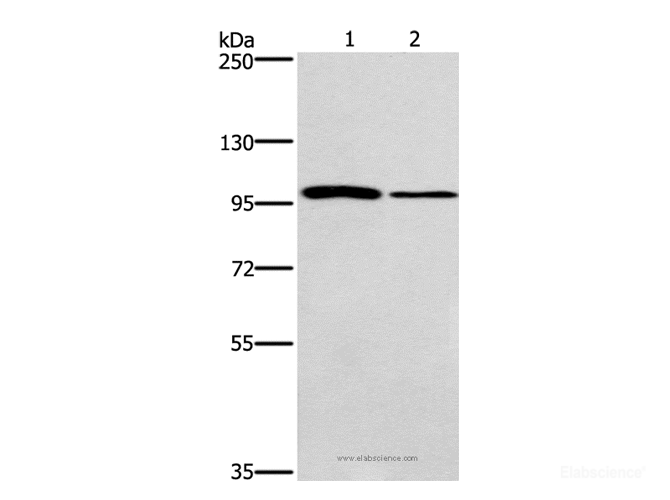 Western Blot analysis of NIH/3T3 and A172 cell using CARD14 Polyclonal Antibody at dilution of 1:800