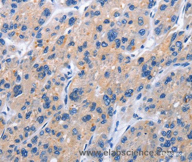 Immunohistochemistry of paraffin-embedded Human brain tissue using CD137 Polyclonal Antibody at dilution 1:50