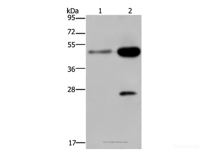 Western Blot analysis of 231 and Hela cell using CD160 Polyclonal Antibody at dilution of 1:300