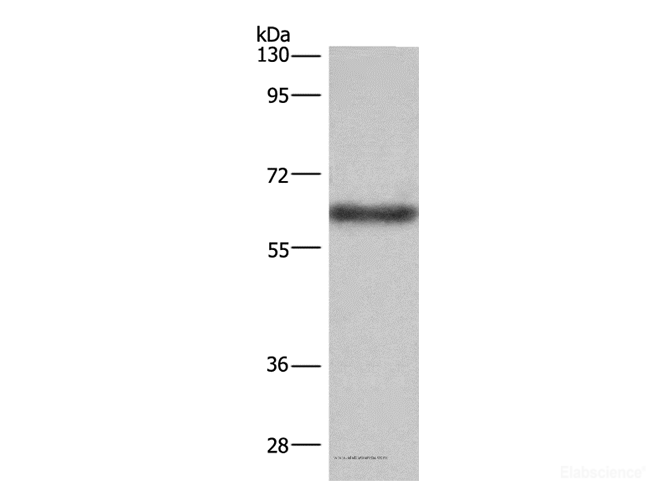 Western Blot analysis of Mouse liver tissue using SIGLEC5 Polyclonal Antibody at dilution of 1:350