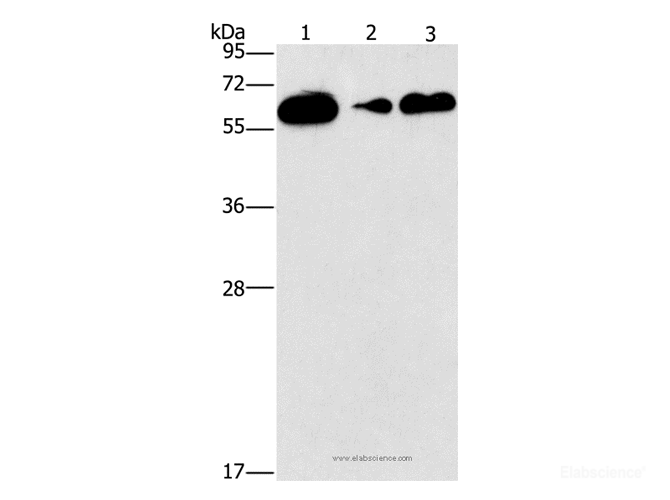 Western Blot analysis of Raji, PC3 and lovo cell using CD27 Polyclonal Antibody at dilution of 1:727