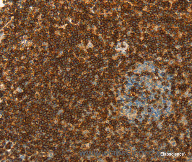 Immunohistochemistry of paraffin-embedded Human tonsil tissue using CD43 Polyclonal Antibody at dilution 1:30