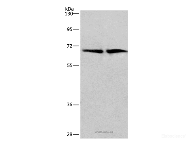Western Blot analysis of Human brain malignant glioma and bladder carcinoma tissue using HSF27 Polyclonal Antibody at dilution of 1:449