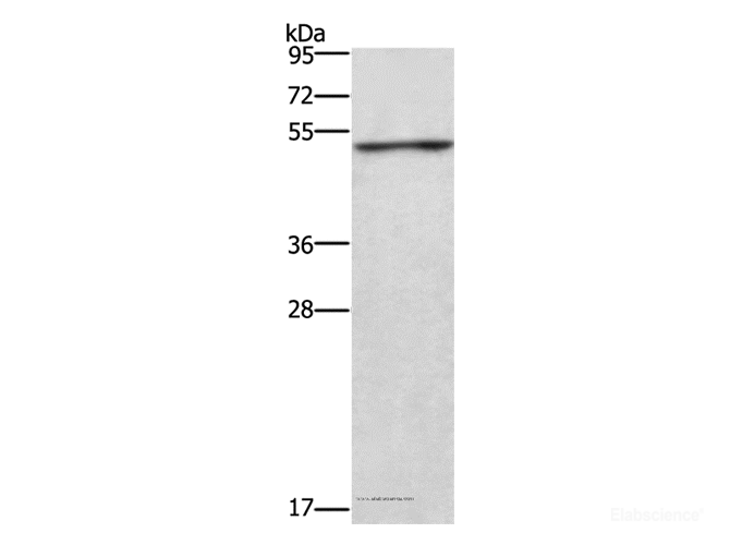 Western Blot analysis of Jurkat cell using CKMT2 Polyclonal Antibody at dilution of 1:700
