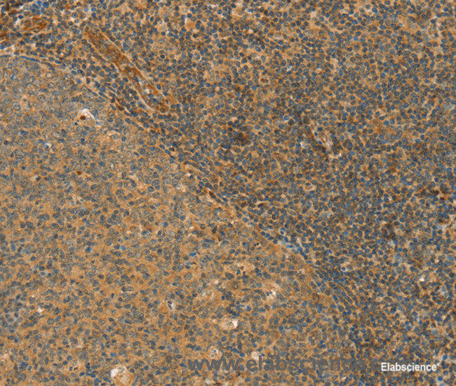Immunohistochemistry of paraffin-embedded Human tonsil tissue using CPA2 Polyclonal Antibody at dilution 1:40