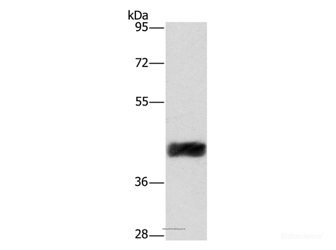 Western Blot analysis of Human fetal liver tissue using CRELD2 Polyclonal Antibody at dilution of 1:421