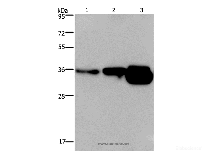 Western Blot analysis of Human breast infiltRative duct and fetal brain tissue, Mouse brain tissue using CUEDC2 Polyclonal Antibody at dilution of 1:600