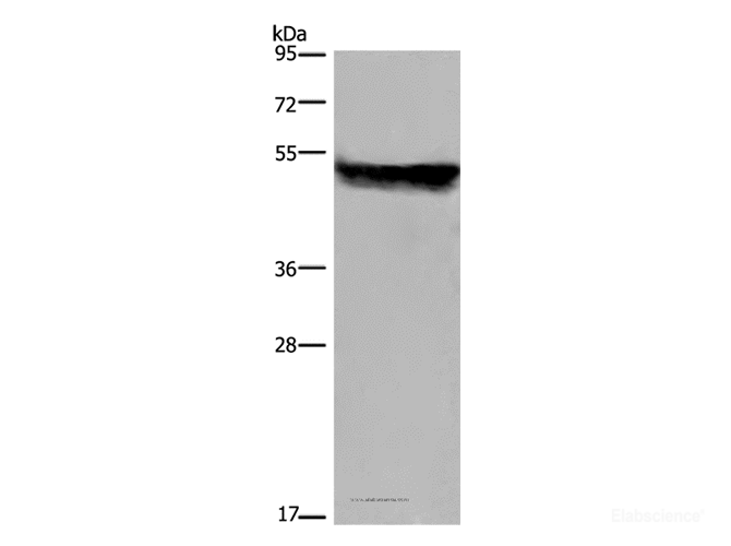 Western Blot analysis of Mouse liver tissue using CYP2E1 Polyclonal Antibody at dilution of 1:250