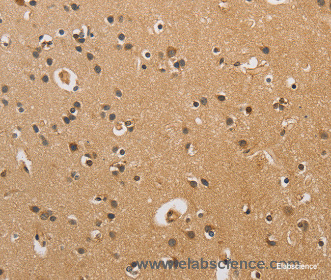 Immunohistochemistry of paraffin-embedded Human brain tissue using CST6 Polyclonal Antibody at dilution 1:70