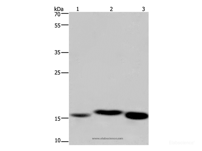 Western Blot analysis of Mouse kidney, Human fetal liver and Mouse liver tissue using Cytochrome b5 Polyclonal Antibody at dilution of 1:250
