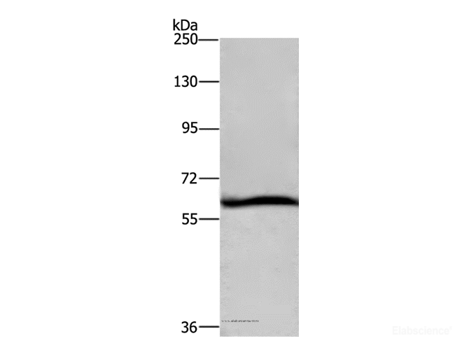Western Blot analysis of Hela cell using DCP1A Polyclonal Antibody at dilution of 1:1100