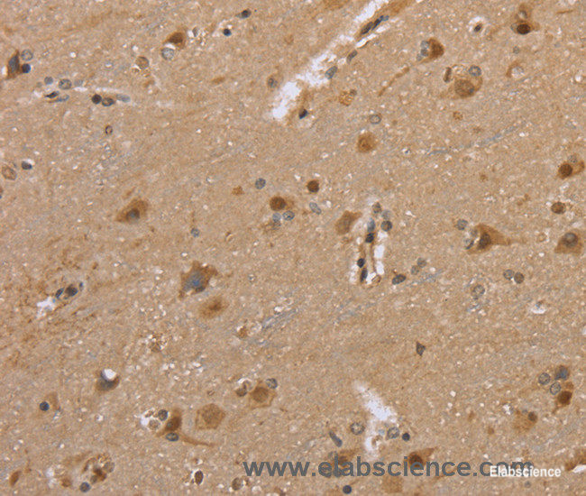 Immunohistochemistry of paraffin-embedded Human brain tissue using DLD Polyclonal Antibody at dilution 1:35