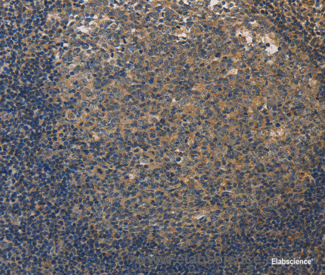 Immunohistochemistry of paraffin-embedded Human tonsil tissue using DUSP26 Polyclonal Antibody at dilution 1:50