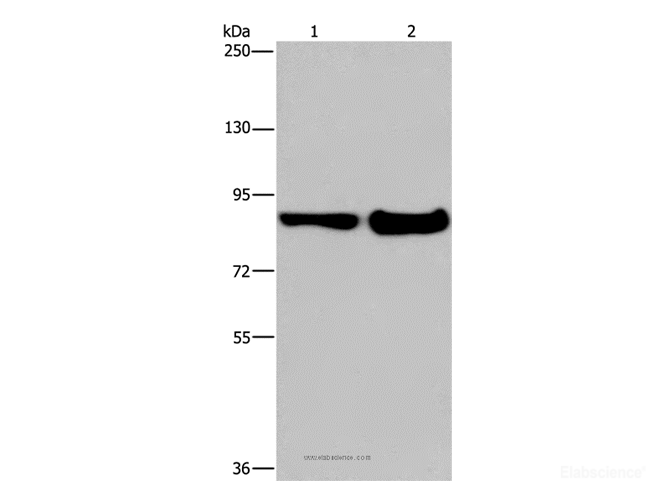 Western Blot analysis of Mouse lung and liver tissue using MAPRE3 Polyclonal Antibody at dilution of 1:1050