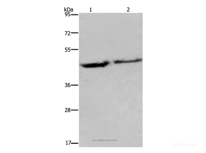 Western Blot analysis of Human adrenal pheochromocytoma and fetal brain tissue using EIF3H Polyclonal Antibody at dilution of 1:1150