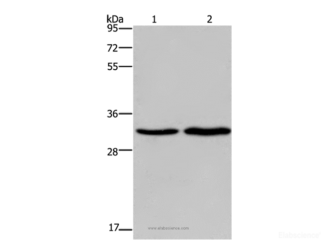Western Blot analysis of Hela and A375 cell using ELOVL1 Polyclonal Antibody at dilution of 1:550