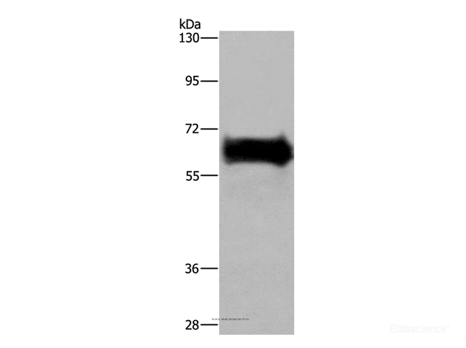 Western Blot analysis of Mouse kidney tissue using EZR Polyclonal Antibody at dilution of 1:300