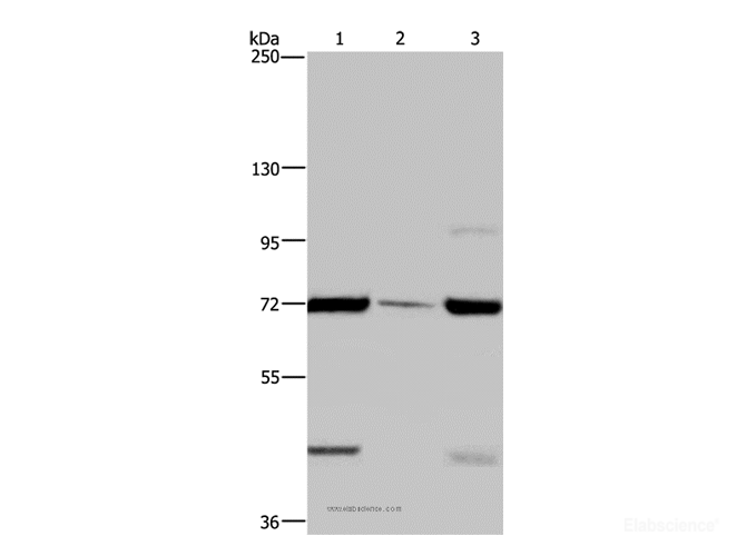 Western Blot analysis of LoVo cell, Human testis tissue and A549 cell using FAAH Polyclonal Antibody at dilution of 1:400