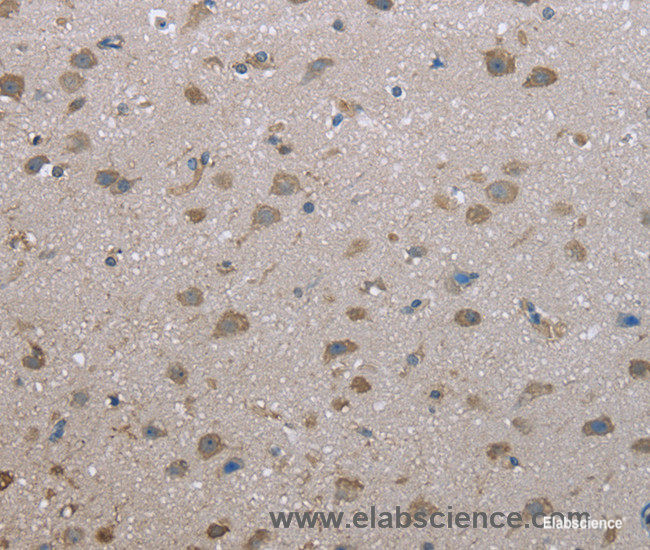 Immunohistochemistry of paraffin-embedded Human brain tissue using FAP Polyclonal Antibody at dilution 1:30