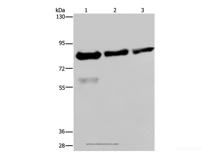 Western Blot analysis of Hela, LoVo and HepG2 cell using FASTKD2 Polyclonal Antibody at dilution of 1:500