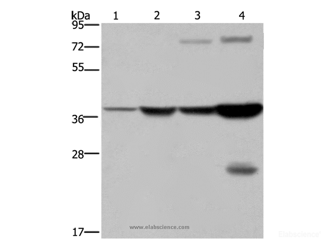 Western Blot analysis of Mouse stomach and Human fetal liver tissue, MCF-7 cell and Mouse liver tissue using FBP1 Polyclonal Antibody at dilution of 1:550