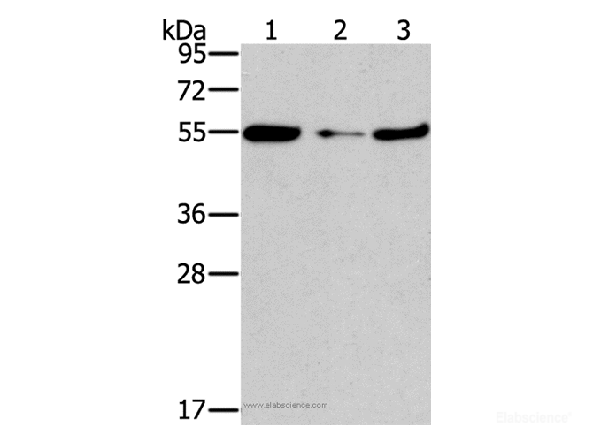 Western Blot analysis of Mouse heart tissue and NIH/3T3 cell, Mouse liver tissue using FGFR1OP Polyclonal Antibody at dilution of 1:850
