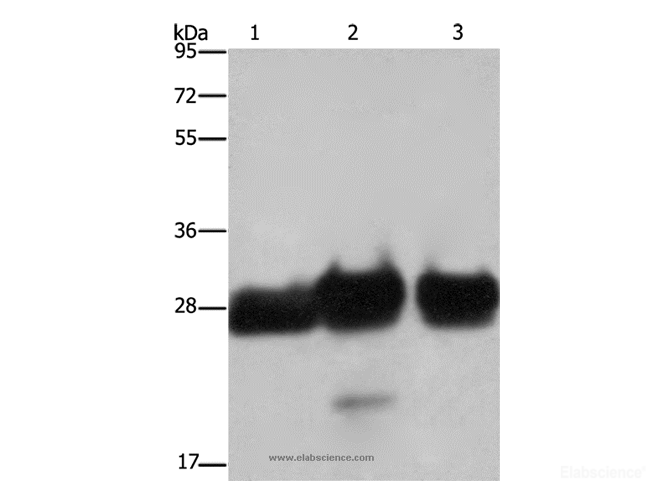 Western Blot analysis of Human adrenal pheochromocytoma, fetal muscle and skeletal muscle tissue using FHL1 Polyclonal Antibody at dilution of 1:500