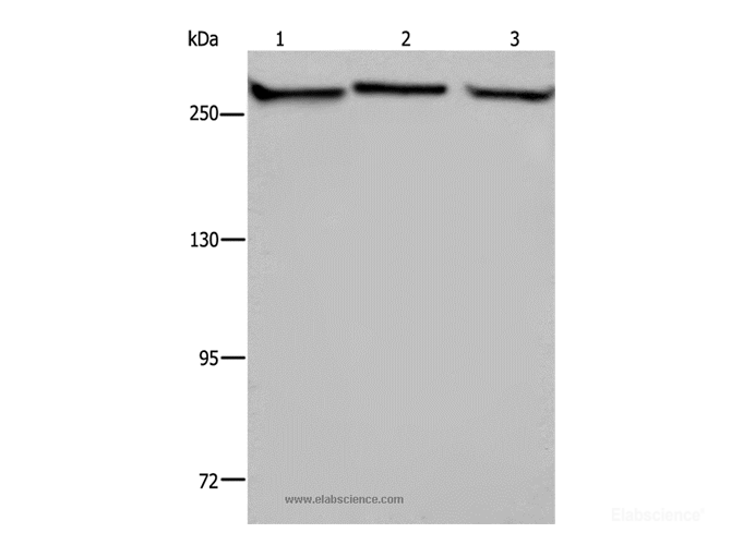 Western Blot analysis of PC3, NIH/3T3 and HUVEC cell using FLNA Polyclonal Antibody at dilution of 1:1100